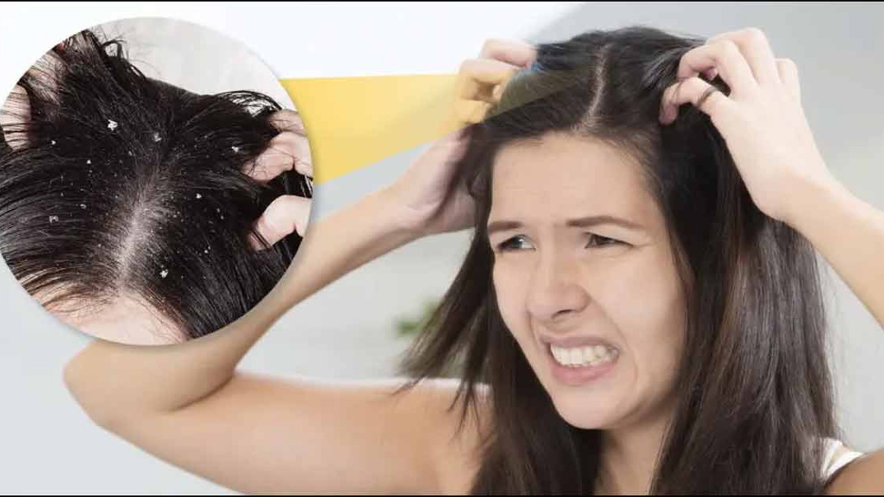 শীতকালে মাথার ত্বকে চুলকানির কারন ও প্রতিকার